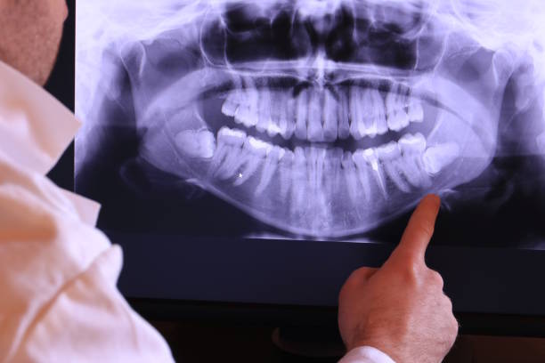 Best Emergency Dental Care for Abscessed Tooth in Big Rapids, MI