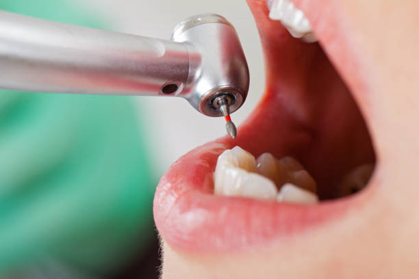 Best Emergency Dental Extractions in Big Rapids, MI